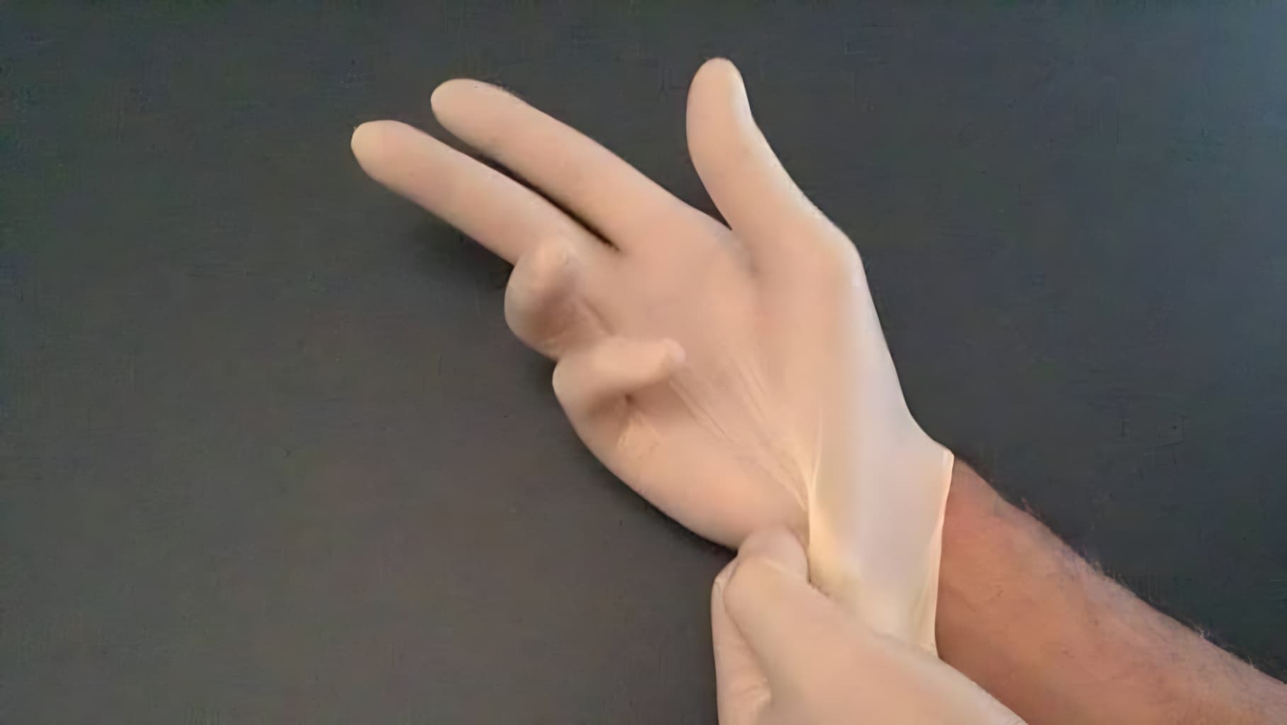 Cover Image for India: Supreme Court Bans Two-Finger Test In Rape Cases